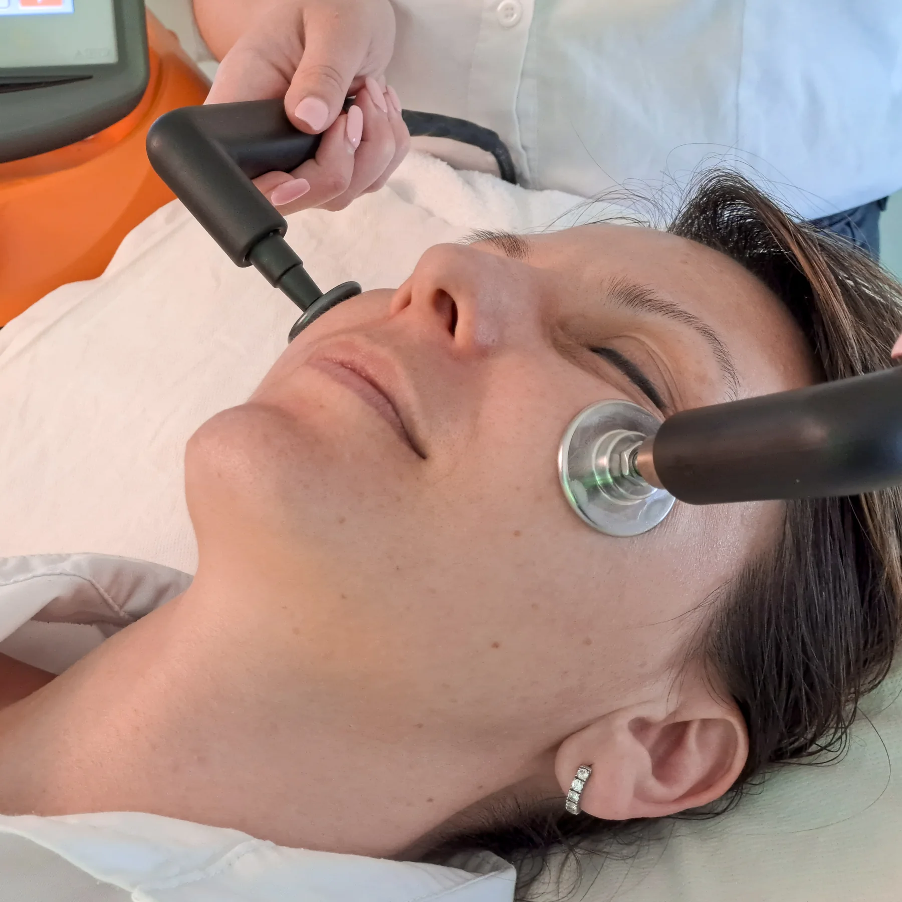 INDIBA-Radiofrequenzbehandlung im Gesicht